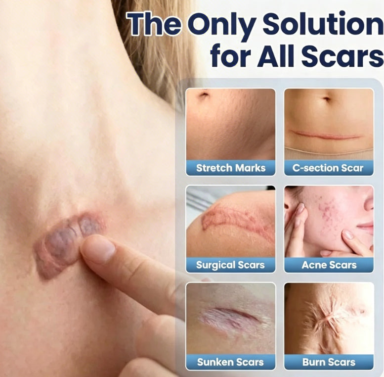 🏆 Advanced Scar Repair Cream – Fade Scars, Smooth Skin & Restore Confidence ✨-CU