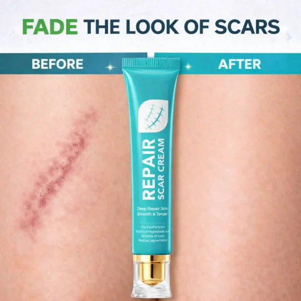 🏆 Advanced Scar Repair Cream – Fade Scars, Smooth Skin & Restore Confidence ✨-CU